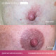 Perma Blend Luxe - The Unstoppable Areola Set (8x 1/2 oz)